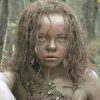 Они росли в джунглях совершенно одни: история Камалы и Амалы