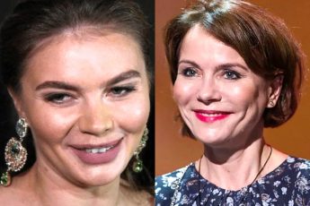 7 бывших красавиц, которые растеряли свою красоту и очарование после ботокса и пластики